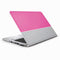 Pink and Grey Stripes HP Elitebook Skin